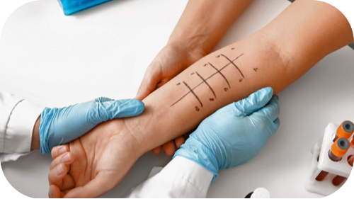 Arm with marked areas for allergy testing.