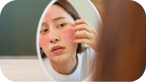 Teen age girl looking in mirror and examining her eczema on her face.